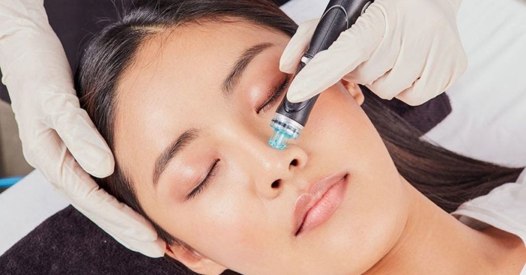 Everything You Need To Know About The HydraFacial Treatment