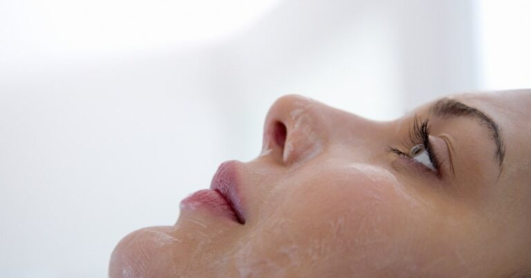 Chemical Peels vs Laser Resurfacing for Acne Scars