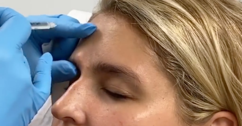 Can Botox Be a Preventative Treatment