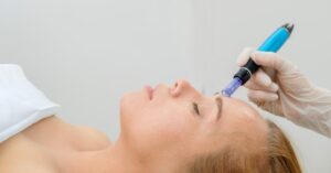 The Differences Between Professional and at-home Microneedling
