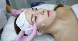 How is Sculptra Different from Traditional Fillers