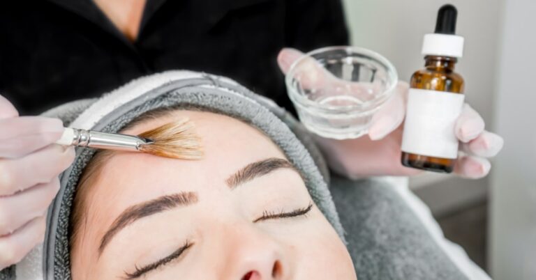 5 Benefits of a Chemical Peel