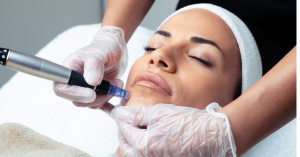 Virtue RF Microneedling