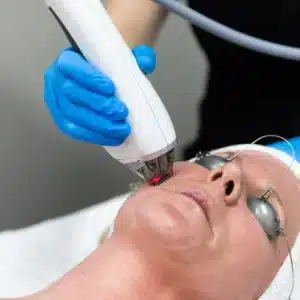 sun damage repair